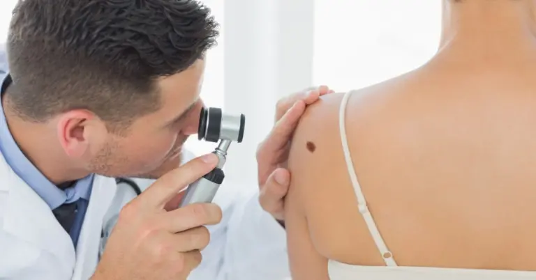 Dermatology