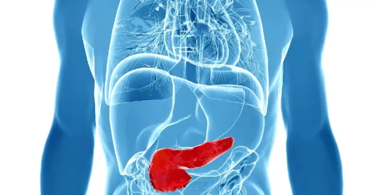 Pancreatic cancer