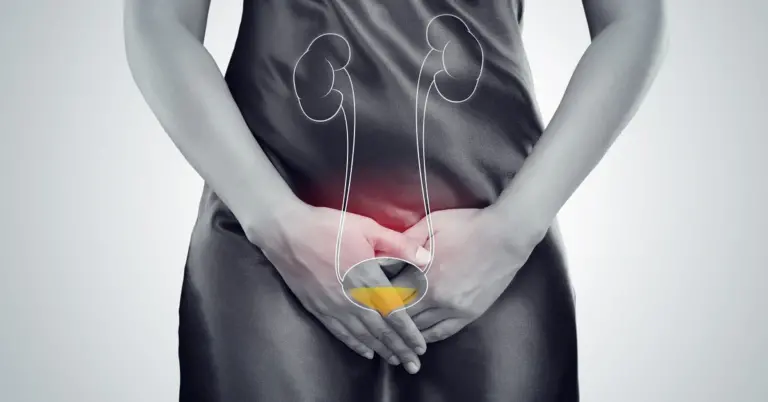 Urinary inflammation